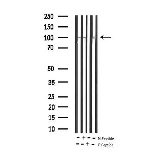 Phospho-STAT6 (Thr645) Antibody in Western Blot (WB)