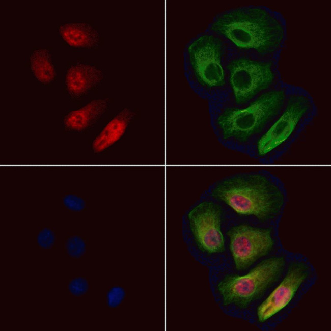 Phospho-STAT5 alpha/beta (Ser726, Ser731) Antibody in Immunocytochemistry (ICC/IF)