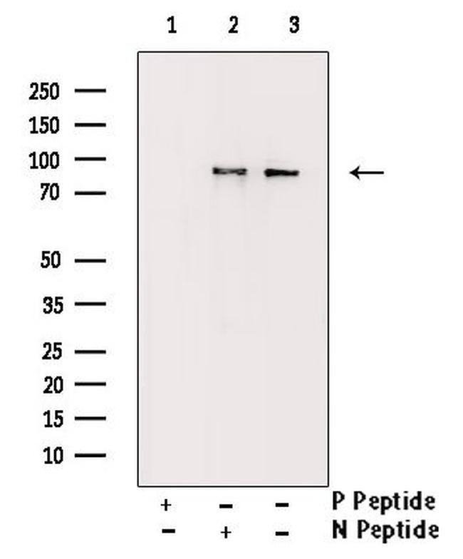 Phospho-STAT5 alpha/beta (Ser726, Ser731) Antibody in Western Blot (WB)