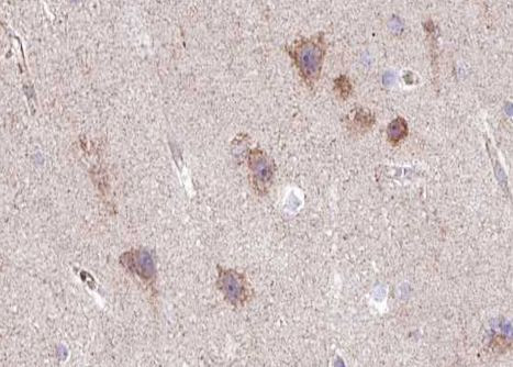 Phospho-GluR2 (Ser880) Antibody in Immunohistochemistry (Paraffin) (IHC (P))