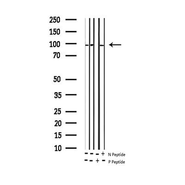 Phospho-GluR2 (Ser880) Antibody in Western Blot (WB)