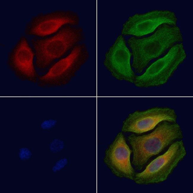 Phospho-mTOR (Ser2481) Antibody in Immunocytochemistry (ICC/IF)