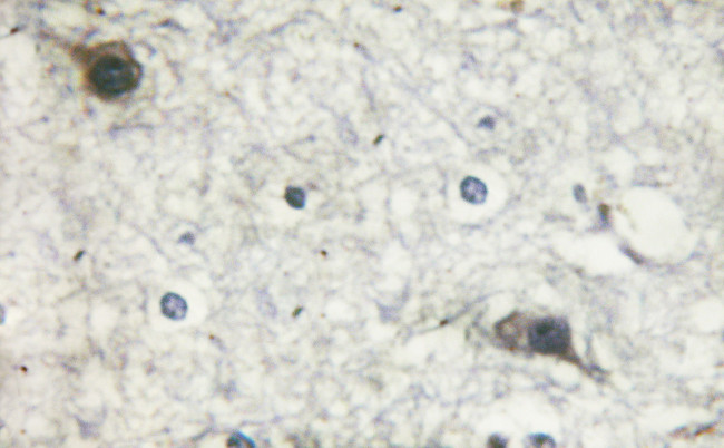 Phospho-mTOR (Ser2481) Antibody in Immunohistochemistry (Paraffin) (IHC (P))