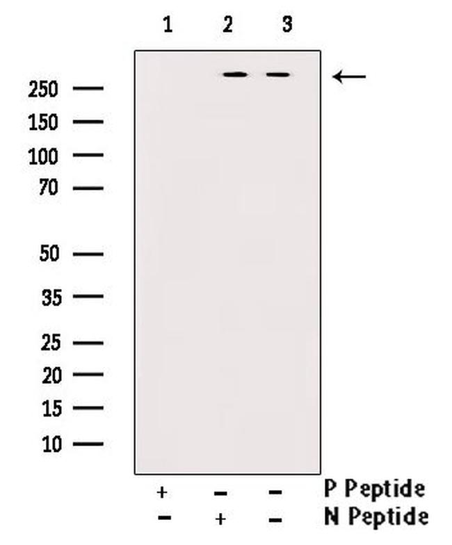 Phospho-mTOR (Ser2481) Antibody in Western Blot (WB)