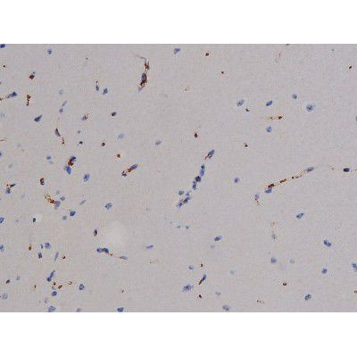 Phospho-ZAP-70 (Tyr319) Antibody in Immunohistochemistry (Paraffin) (IHC (P))