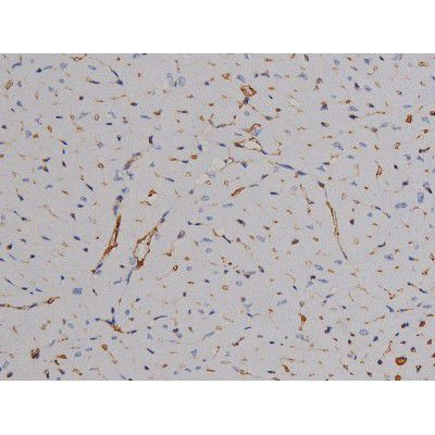 Phospho-ZAP-70 (Tyr319) Antibody in Immunohistochemistry (Paraffin) (IHC (P))