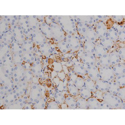 Phospho-ZAP-70 (Tyr319) Antibody in Immunohistochemistry (Paraffin) (IHC (P))