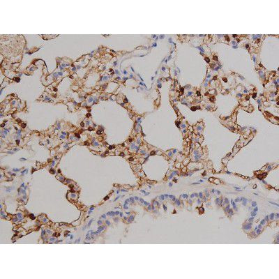 Phospho-ZAP-70 (Tyr319) Antibody in Immunohistochemistry (Paraffin) (IHC (P))