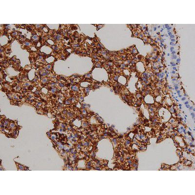 Phospho-ZAP-70 (Tyr319) Antibody in Immunohistochemistry (Paraffin) (IHC (P))