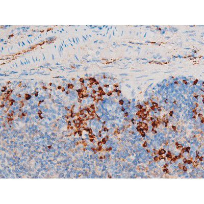 Phospho-SYK (Tyr348) Antibody in Immunohistochemistry (Paraffin) (IHC (P))