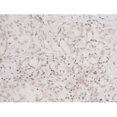 Phospho-SYK (Tyr348) Antibody in Immunohistochemistry (Paraffin) (IHC (P))