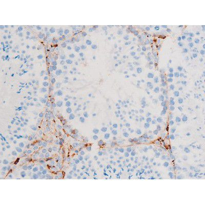 Phospho-SYK (Tyr348) Antibody in Immunohistochemistry (Paraffin) (IHC (P))