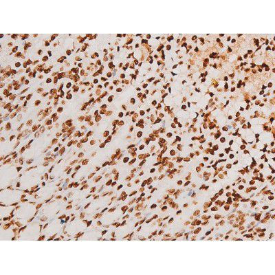 Phospho-SYK (Tyr348) Antibody in Immunohistochemistry (Paraffin) (IHC (P))