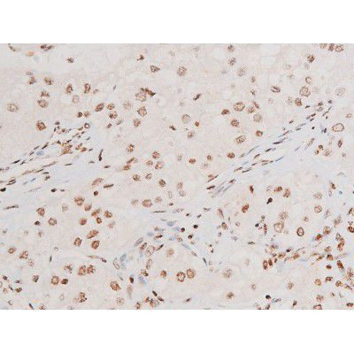 Phospho-SYK (Tyr348) Antibody in Immunohistochemistry (Paraffin) (IHC (P))