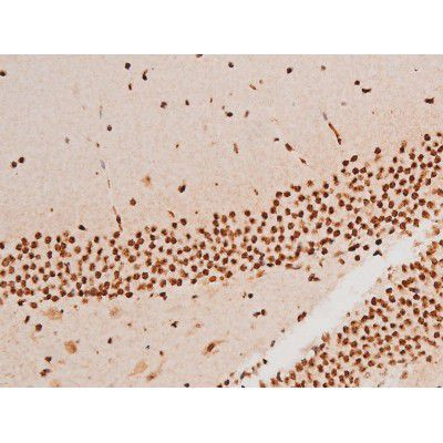 Phospho-SYK (Tyr348) Antibody in Immunohistochemistry (Paraffin) (IHC (P))