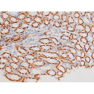 Phospho-SYK (Tyr348) Antibody in Immunohistochemistry (Paraffin) (IHC (P))