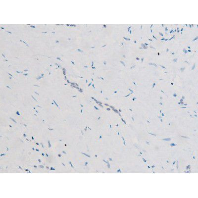 Phospho-SYK (Tyr525) Antibody in Immunohistochemistry (Paraffin) (IHC (P))