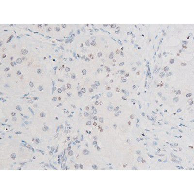 Phospho-SYK (Tyr525) Antibody in Immunohistochemistry (Paraffin) (IHC (P))