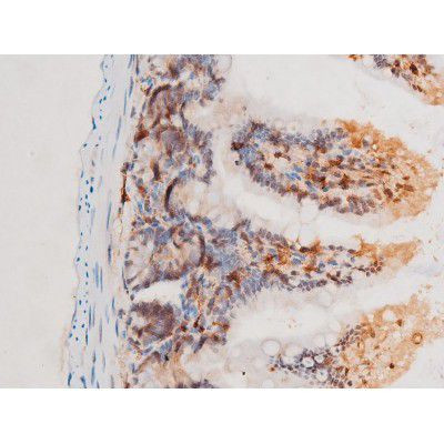 Phospho-SYK (Tyr525) Antibody in Immunohistochemistry (Paraffin) (IHC (P))