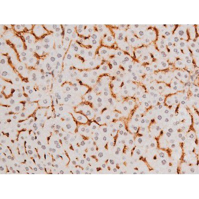 Phospho-SYK (Tyr525) Antibody in Immunohistochemistry (Paraffin) (IHC (P))