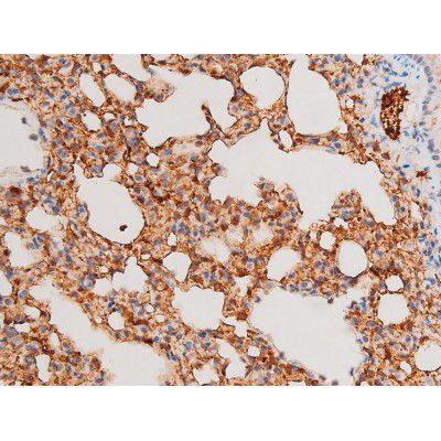 Phospho-SYK (Tyr525) Antibody in Immunohistochemistry (Paraffin) (IHC (P))