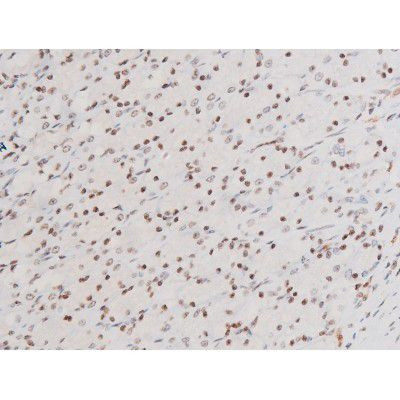 Phospho-SYK (Tyr525) Antibody in Immunohistochemistry (Paraffin) (IHC (P))