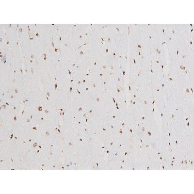 Phospho-SYK (Tyr525) Antibody in Immunohistochemistry (Paraffin) (IHC (P))