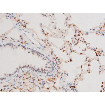 Phospho-SYK (Tyr525) Antibody in Immunohistochemistry (Paraffin) (IHC (P))