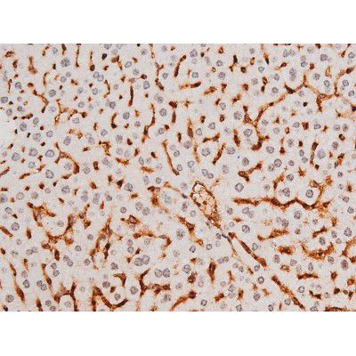 Phospho-SYK (Tyr525) Antibody in Immunohistochemistry (Paraffin) (IHC (P))