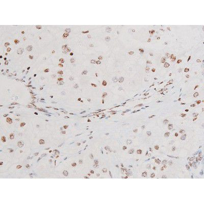 Phospho-SYK (Tyr525) Antibody in Immunohistochemistry (Paraffin) (IHC (P))