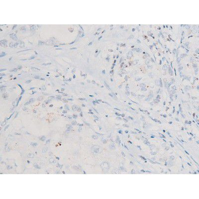 Phospho-SYK (Tyr525) Antibody in Immunohistochemistry (Paraffin) (IHC (P))