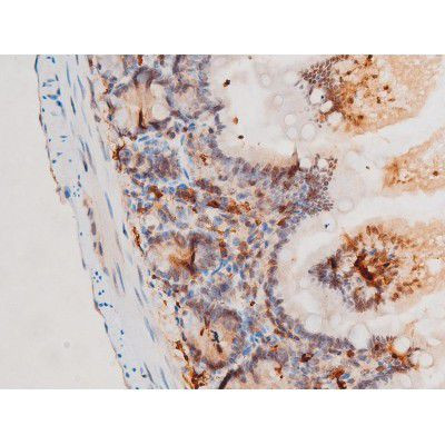 Phospho-SYK (Tyr525) Antibody in Immunohistochemistry (Paraffin) (IHC (P))