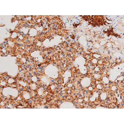 Phospho-SYK (Tyr525) Antibody in Immunohistochemistry (Paraffin) (IHC (P))