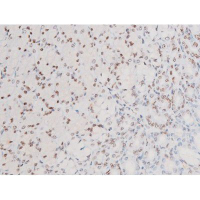 Phospho-SYK (Tyr525) Antibody in Immunohistochemistry (Paraffin) (IHC (P))