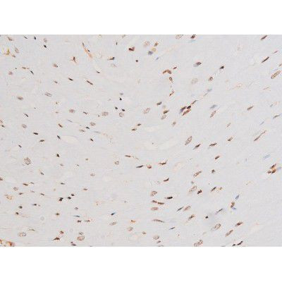 Phospho-SYK (Tyr525) Antibody in Immunohistochemistry (Paraffin) (IHC (P))