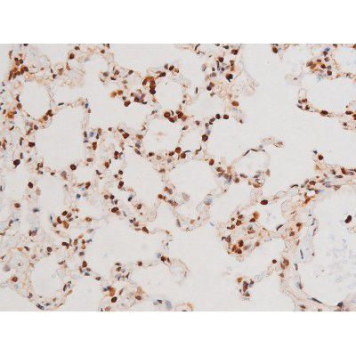 Phospho-SYK (Tyr525) Antibody in Immunohistochemistry (Paraffin) (IHC (P))