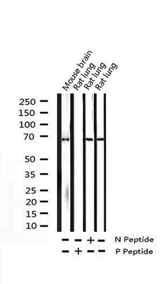Phospho-SYK (Tyr525) Antibody in Western Blot (WB)