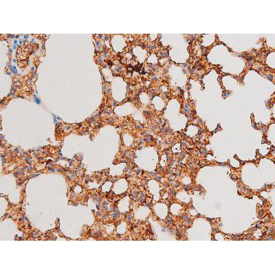 Phospho-GATA4 (Ser262) Antibody in Immunohistochemistry (Paraffin) (IHC (P))