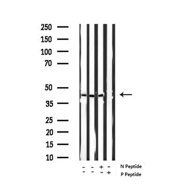 Phospho-GATA4 (Ser262) Antibody in Western Blot (WB)