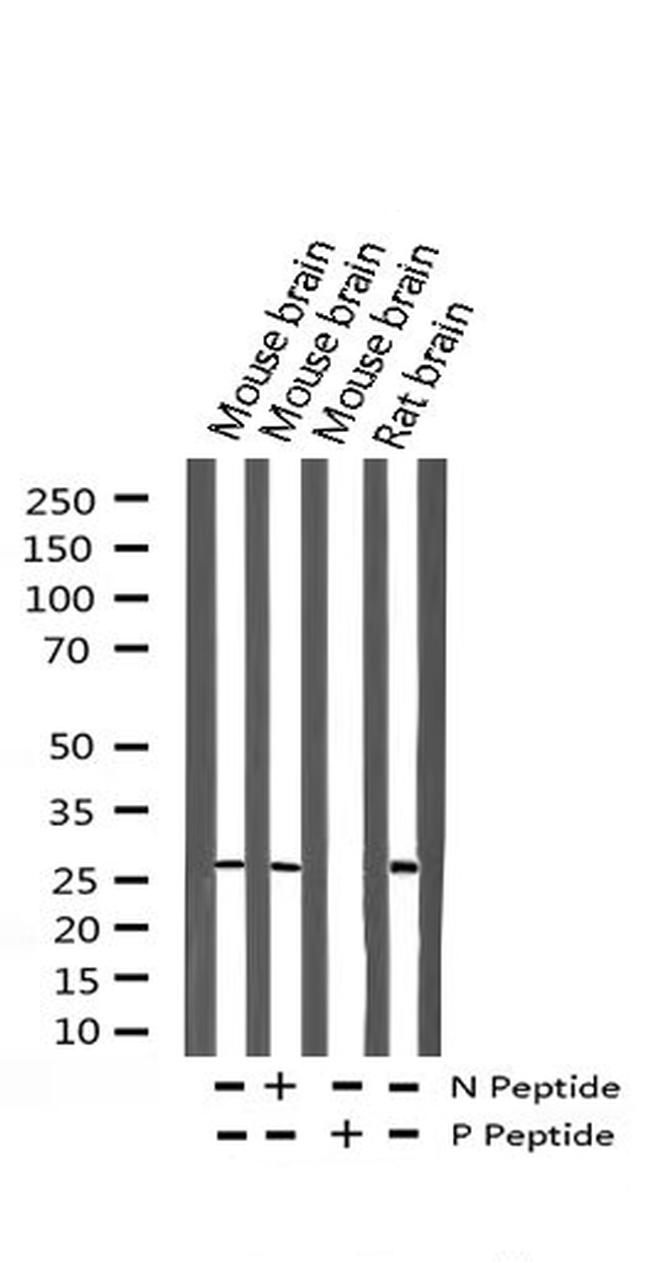 Phospho-p27 Kip1 (Thr187) Antibody in Western Blot (WB)