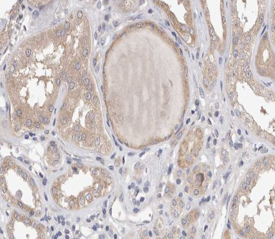 Phospho-PLA2G4A (Ser505) Antibody in Immunohistochemistry (Paraffin) (IHC (P))