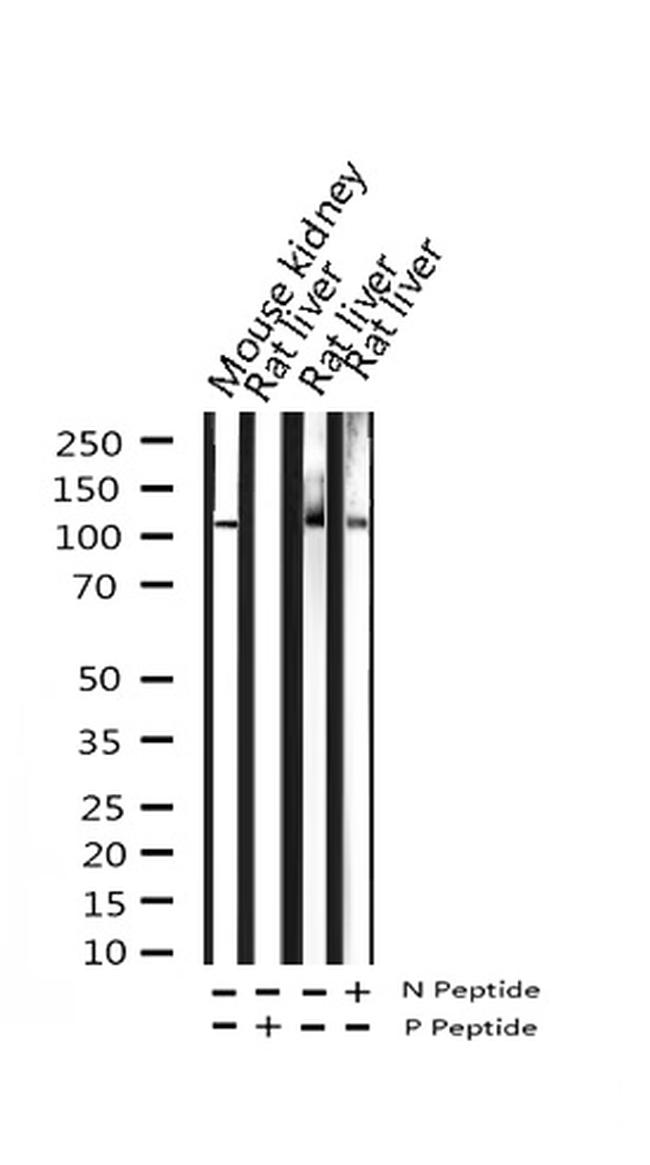 Phospho-PLA2G4A (Ser505) Antibody in Western Blot (WB)