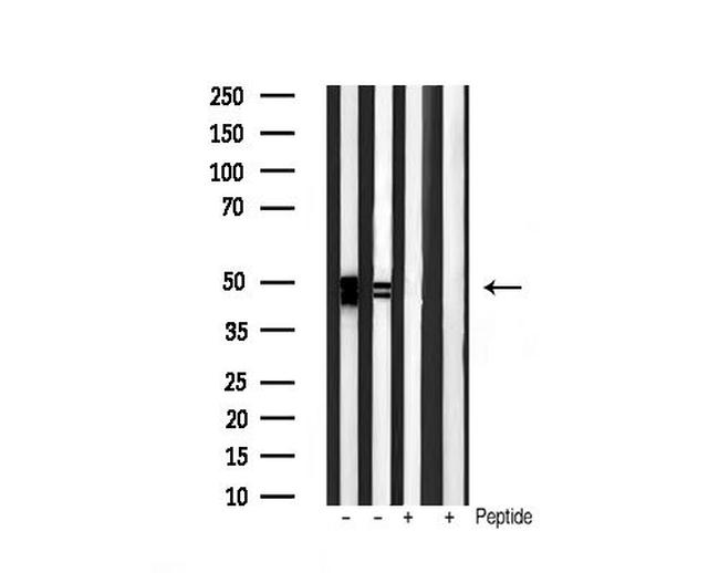 Phospho-GSK3 alpha/beta (Tyr279, Tyr216) Antibody in Western Blot (WB)