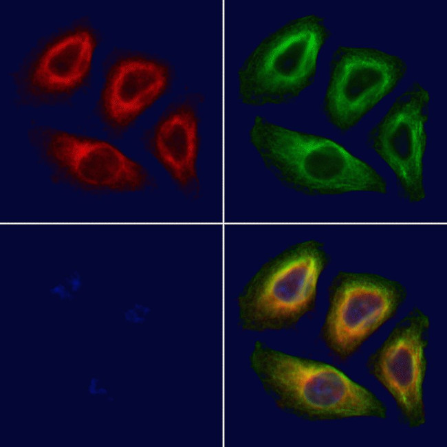 Phospho-ETK (Tyr566) Antibody in Immunocytochemistry (ICC/IF)