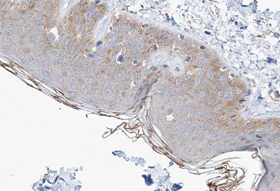 Phospho-ETK (Tyr566) Antibody in Immunohistochemistry (Paraffin) (IHC (P))