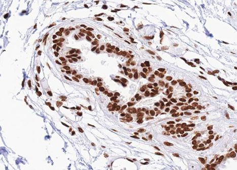 Phospho-STAT2 (Tyr690) Antibody in Immunohistochemistry (Paraffin) (IHC (P))