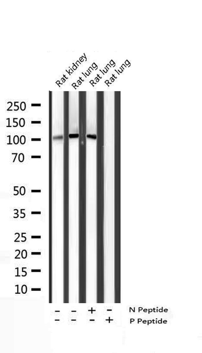 Phospho-STAT2 (Tyr690) Antibody in Western Blot (WB)