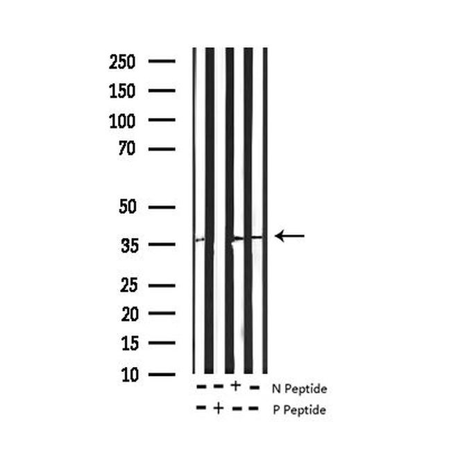 Phospho-Ephrin B2 (Tyr330) Antibody in Western Blot (WB)