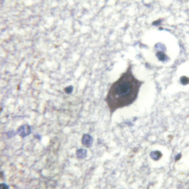 Phospho-LIMK2 (Ser283) Antibody in Immunohistochemistry (Paraffin) (IHC (P))