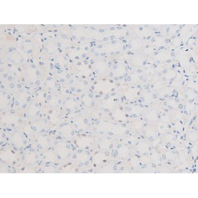 Phospho-LIMK2 (Ser283) Antibody in Immunohistochemistry (Paraffin) (IHC (P))